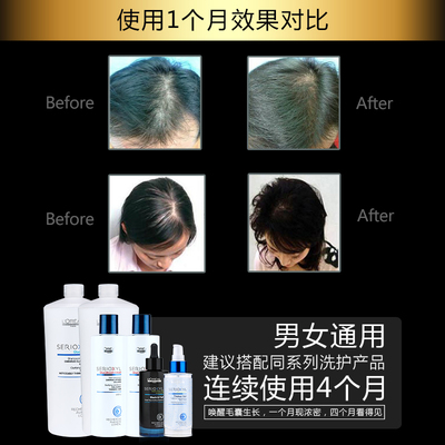 科技賦能防脫，歐萊雅芯基源洗護(hù)套裝 深入發(fā)芯，重塑強(qiáng)韌發(fā)絲